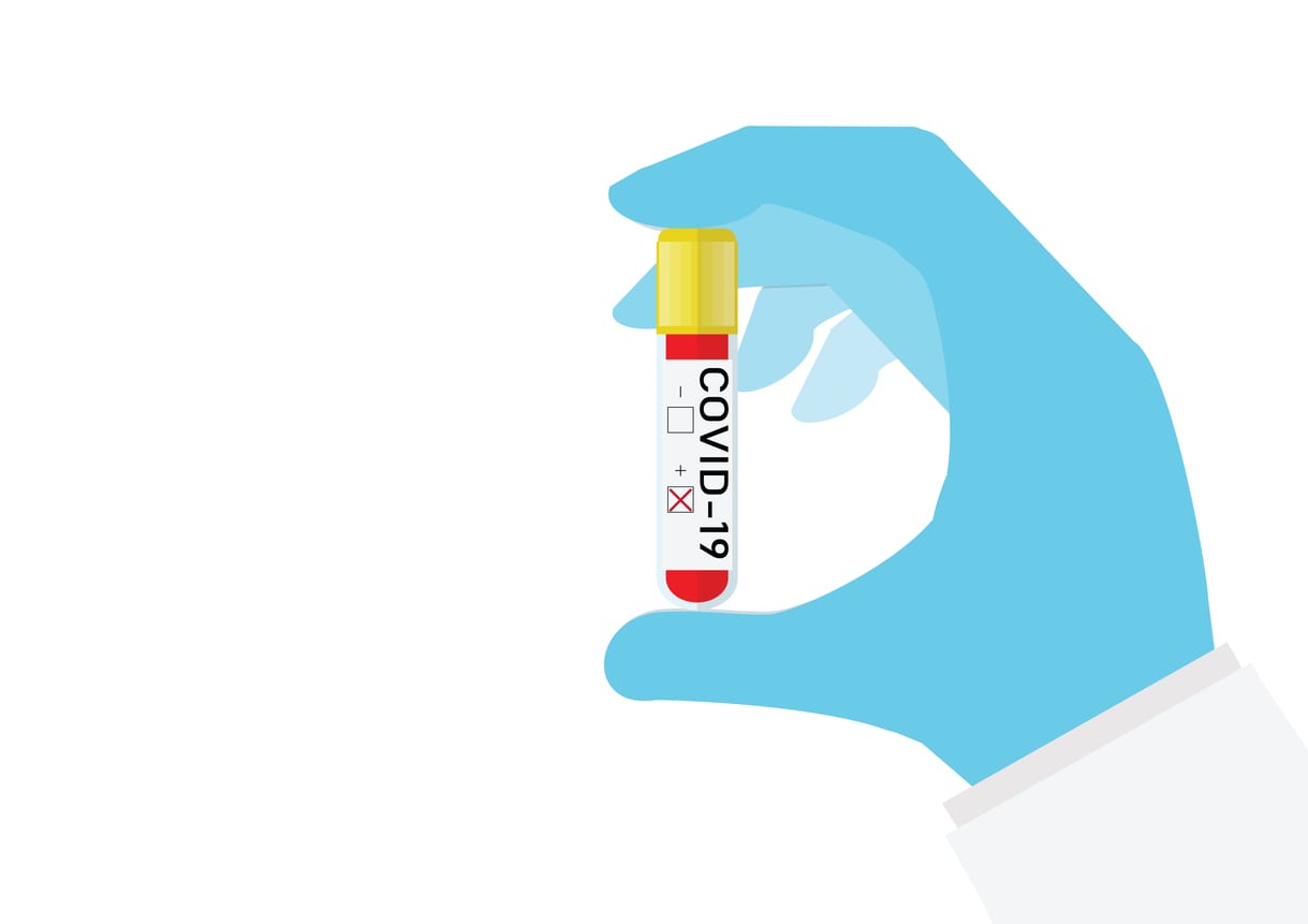 Hand holding test tube with blood sample for COVID-19 test. stock illustration